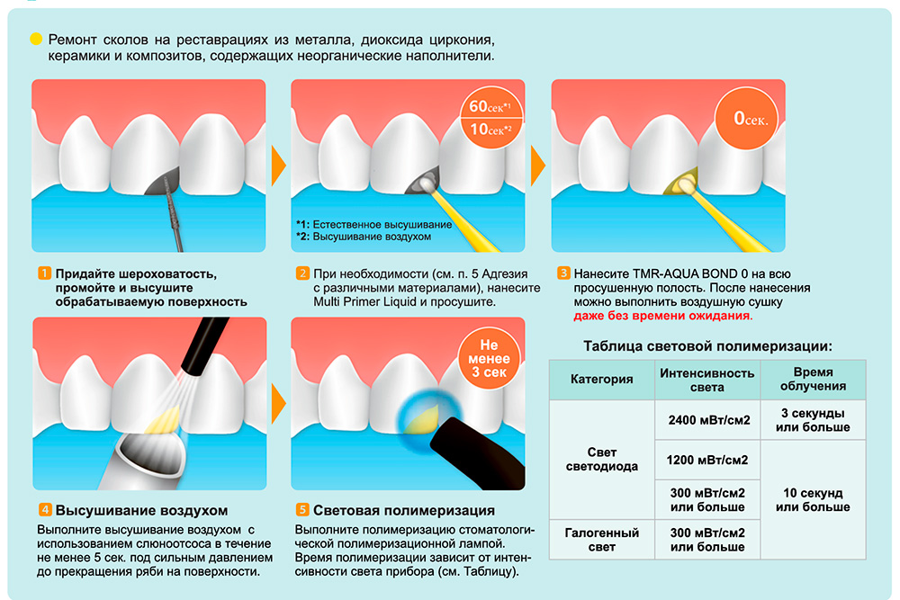 Ямакинаквабонд9
